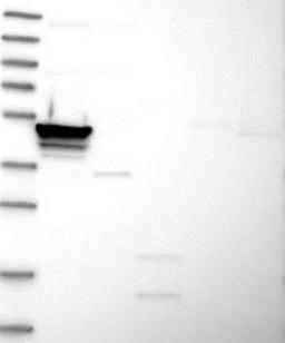 Western Blot: C1orf129 Antibody [NBP1-90843] - Lane 1: Marker [kDa] 230, 130, 95, 72, 56, 36, 28, 17, 11<br/>Lane 2: RT-4<br/>Lane 3: U-251 MG<br/>Lane 4: Human Plasma<br/>Lane 5: Liver<br/>Lane 6: Tonsil