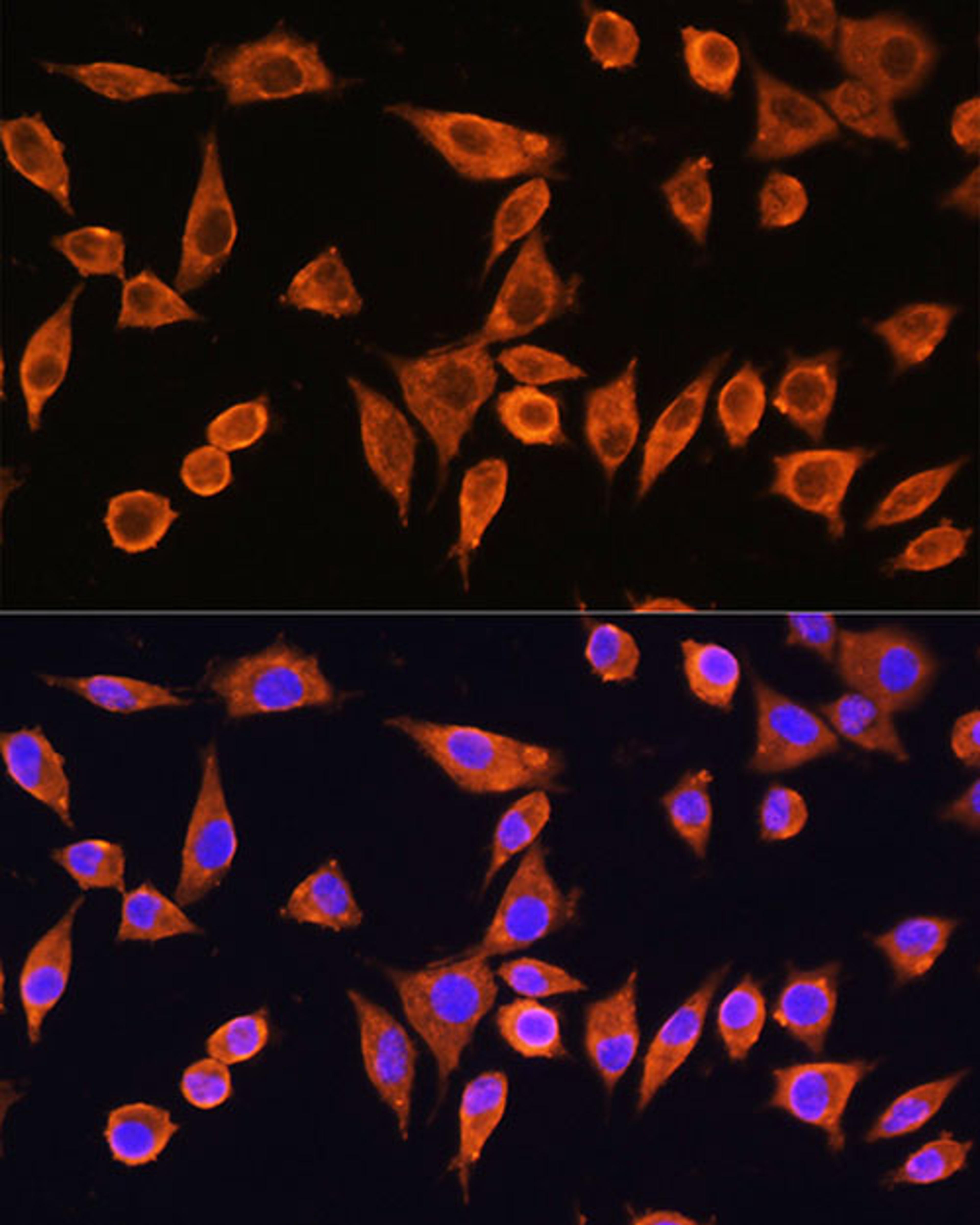 Immunofluorescence - RPS28 Rabbit pAb (A17937)