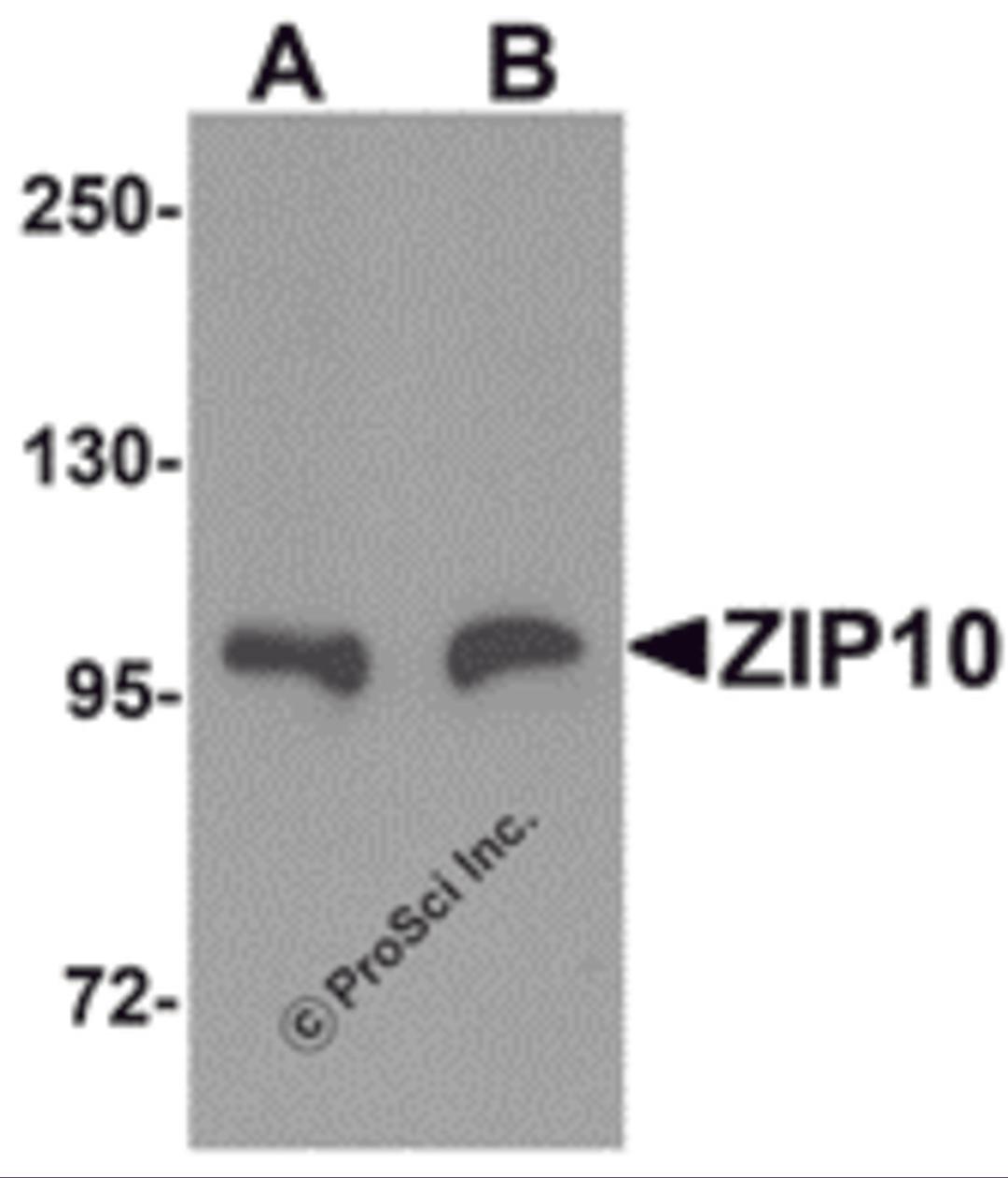 Western blot analysis of ZIP10 in human spleen tissue lysate with ZIP10 antibody at (A) 1 and (B) 2 &#956;g/mL.