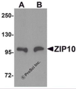 Western blot analysis of ZIP10 in human spleen tissue lysate with ZIP10 antibody at (A) 1 and (B) 2 &#956;g/mL.