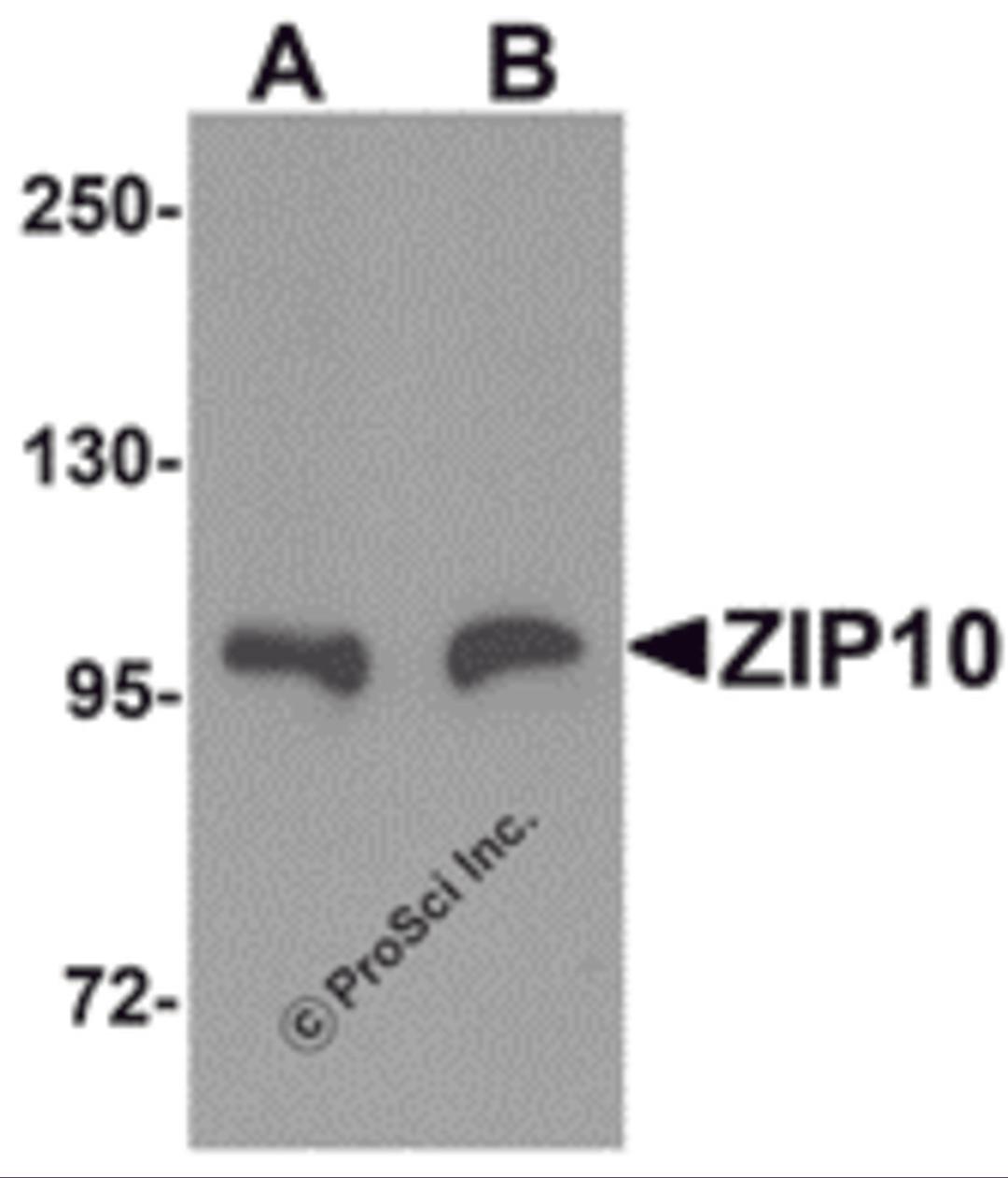 Western blot analysis of ZIP10 in human spleen tissue lysate with ZIP10 antibody at (A) 1 and (B) 2 μg/mL.