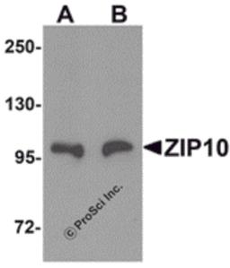 Western blot analysis of ZIP10 in human spleen tissue lysate with ZIP10 antibody at (A) 1 and (B) 2 μg/mL.