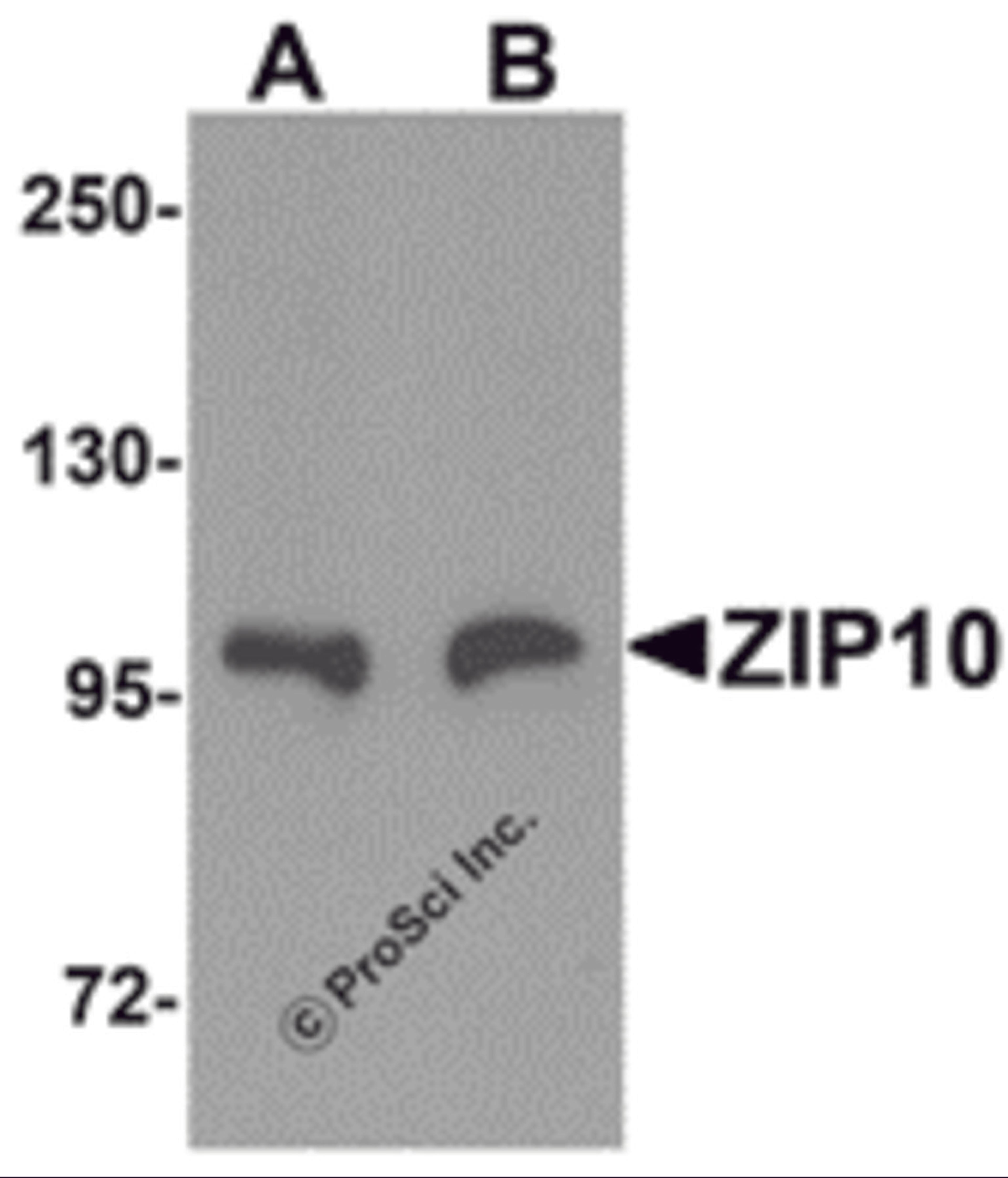 Western blot analysis of ZIP10 in human spleen tissue lysate with ZIP10 antibody at (A) 1 and (B) 2 μg/mL.