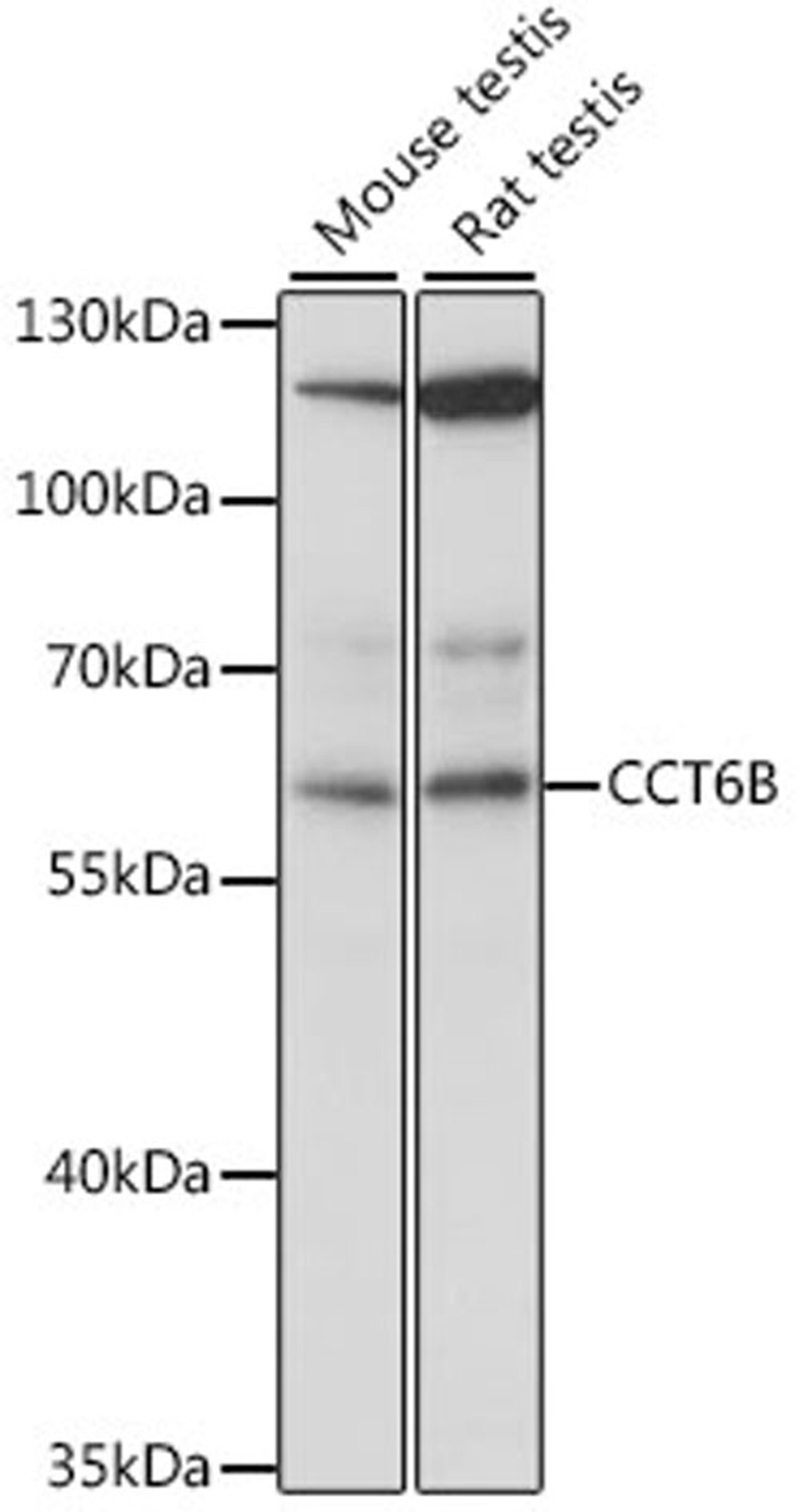 Western blot - CCT6B antibody (A14615)