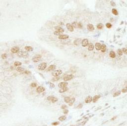 Detection of human SMARCB1/SNF5 by immunohistochemistry.