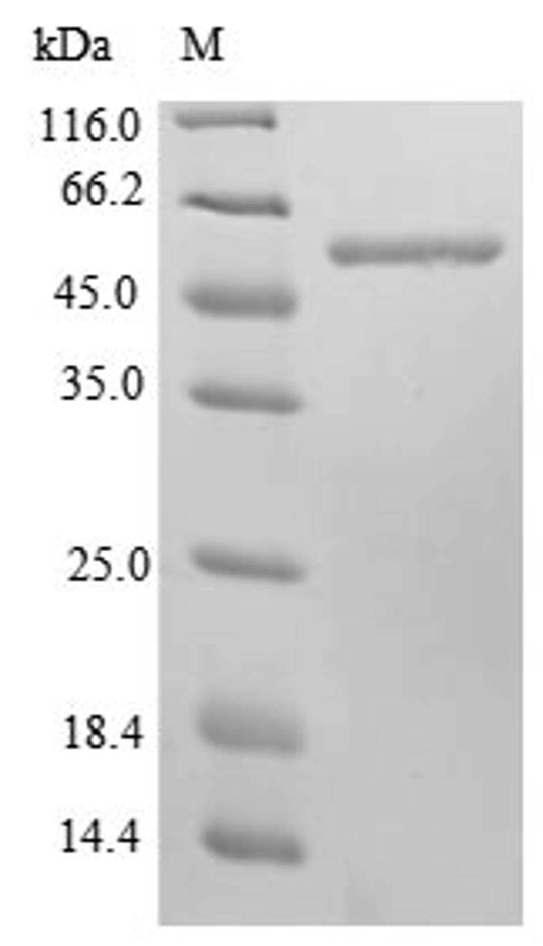 (Tris-Glycine gel) Discontinuous SDS-PAGE (reduced) with 5% enrichment gel and 15% separation gel.
