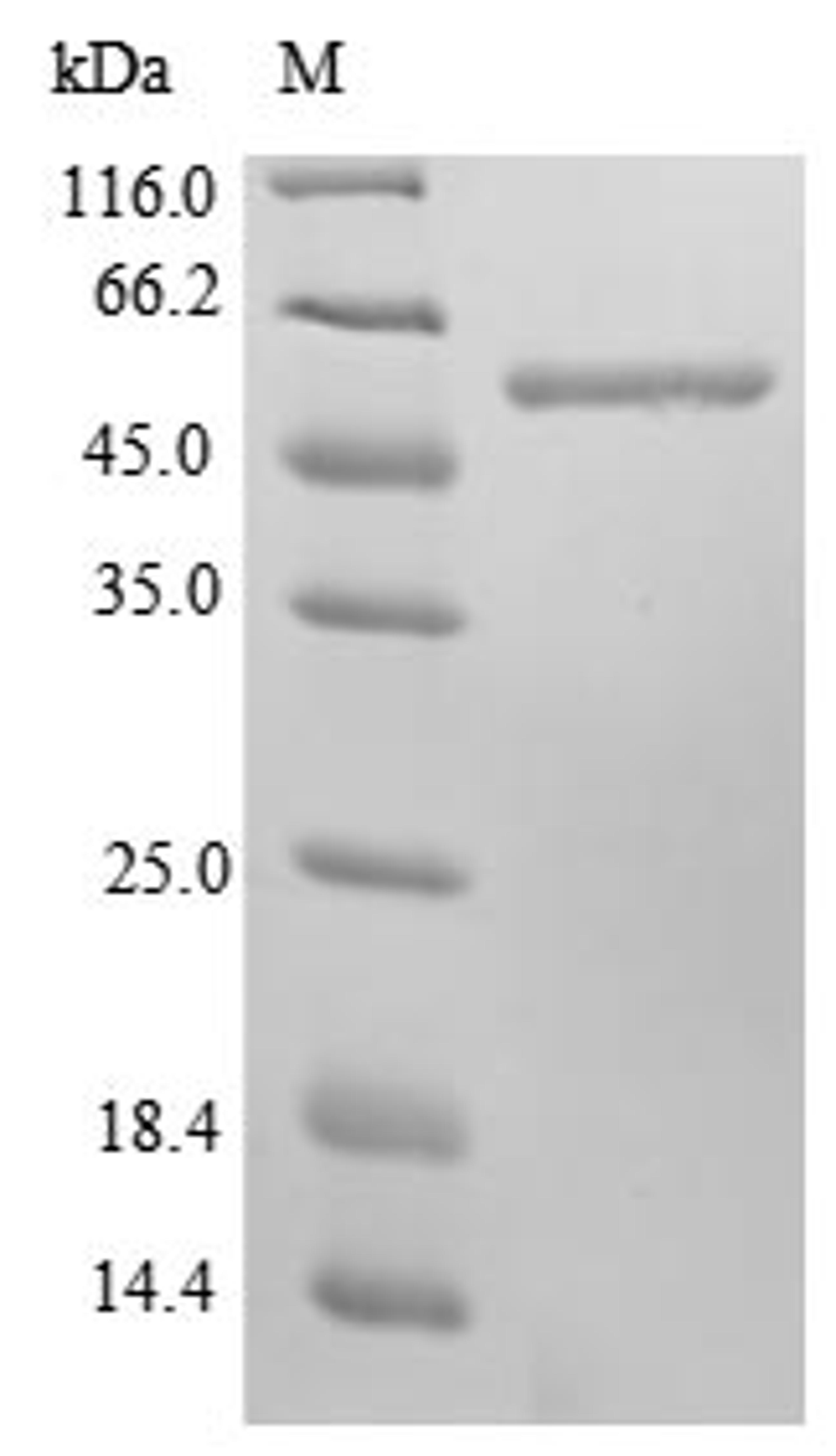 (Tris-Glycine gel) Discontinuous SDS-PAGE (reduced) with 5% enrichment gel and 15% separation gel.
