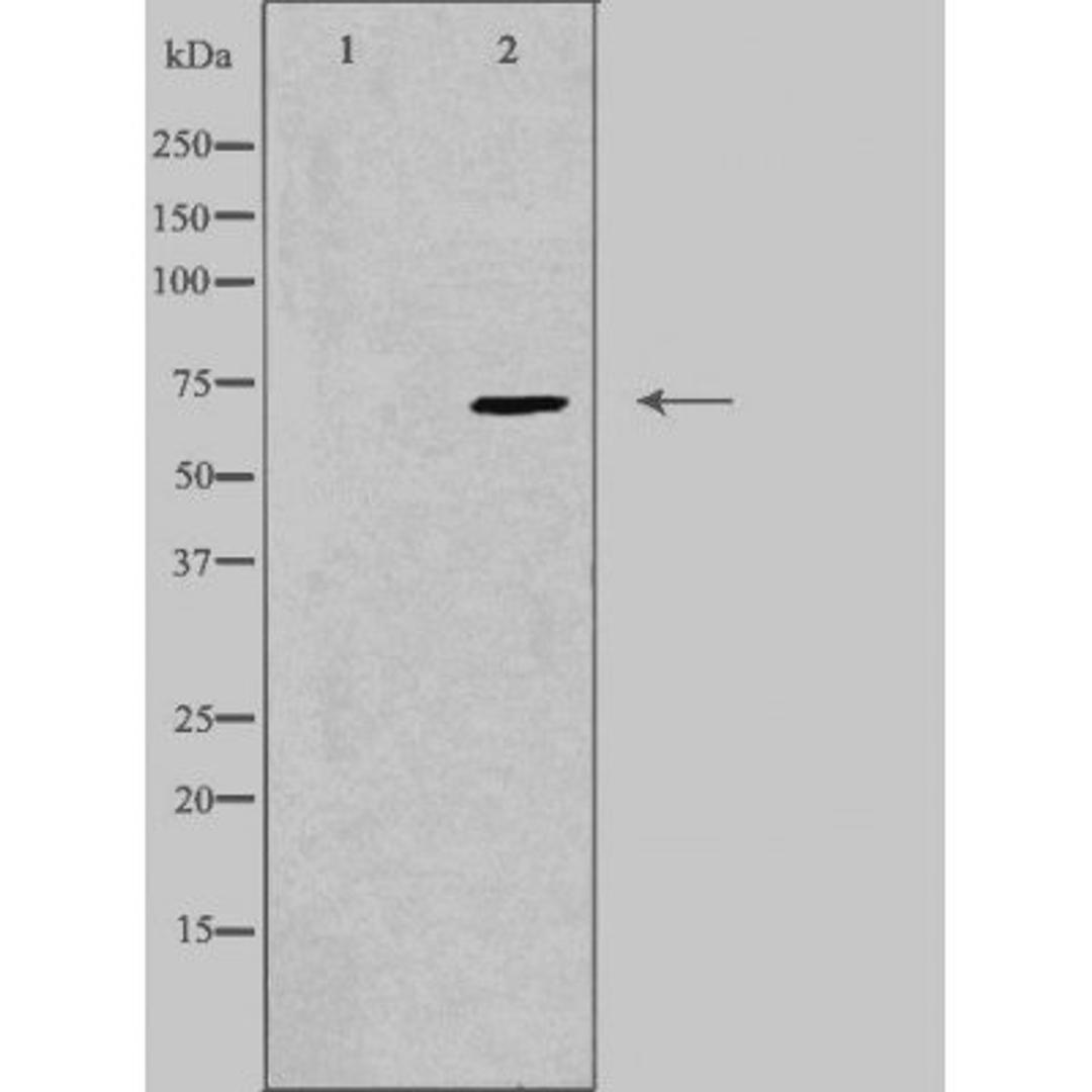 Western blot analysis of K562 cells using PPP2R3B antibody