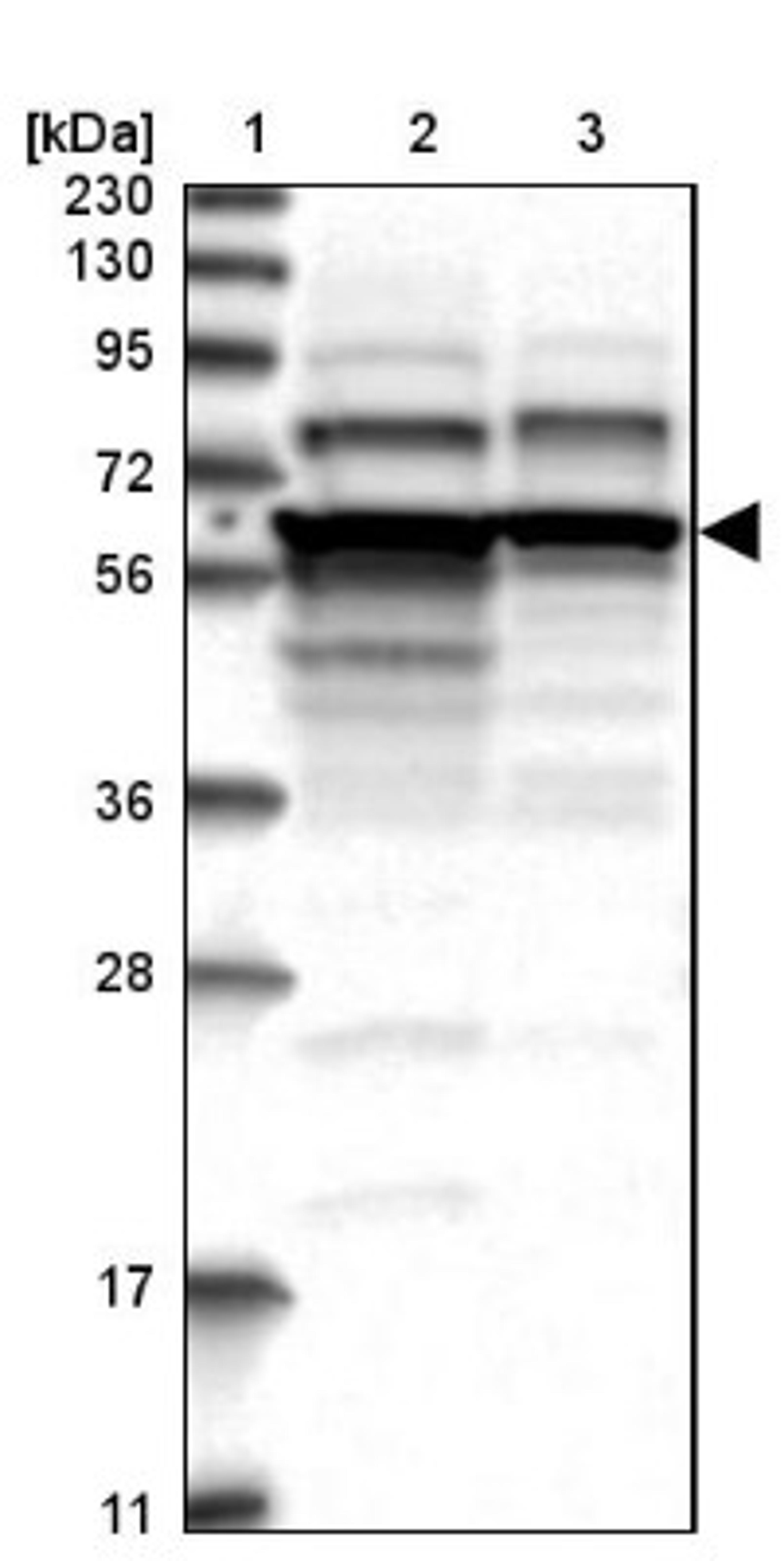 Western Blot: ZCCHC7 Antibody [NBP1-89175] - Lane 1: Marker [kDa] 230, 130, 95, 72, 56, 36, 28, 17, 11<br/>Lane 2: Human cell line RT-4<br/>Lane 3: Human cell line U-251MG sp