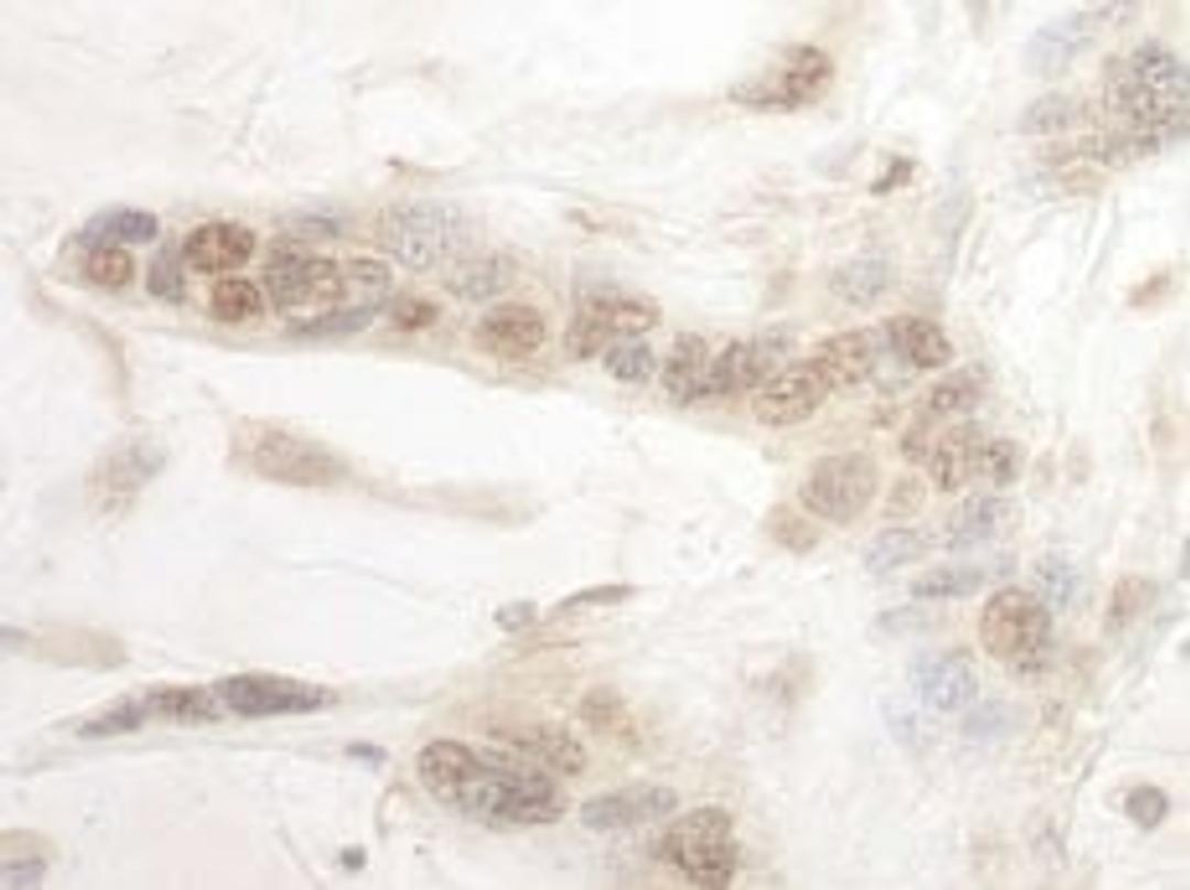 Detection of human ARID3B by immunohistochemistry.