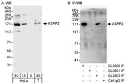 Detection of human ASPP2 by western blot and immunoprecipitation.