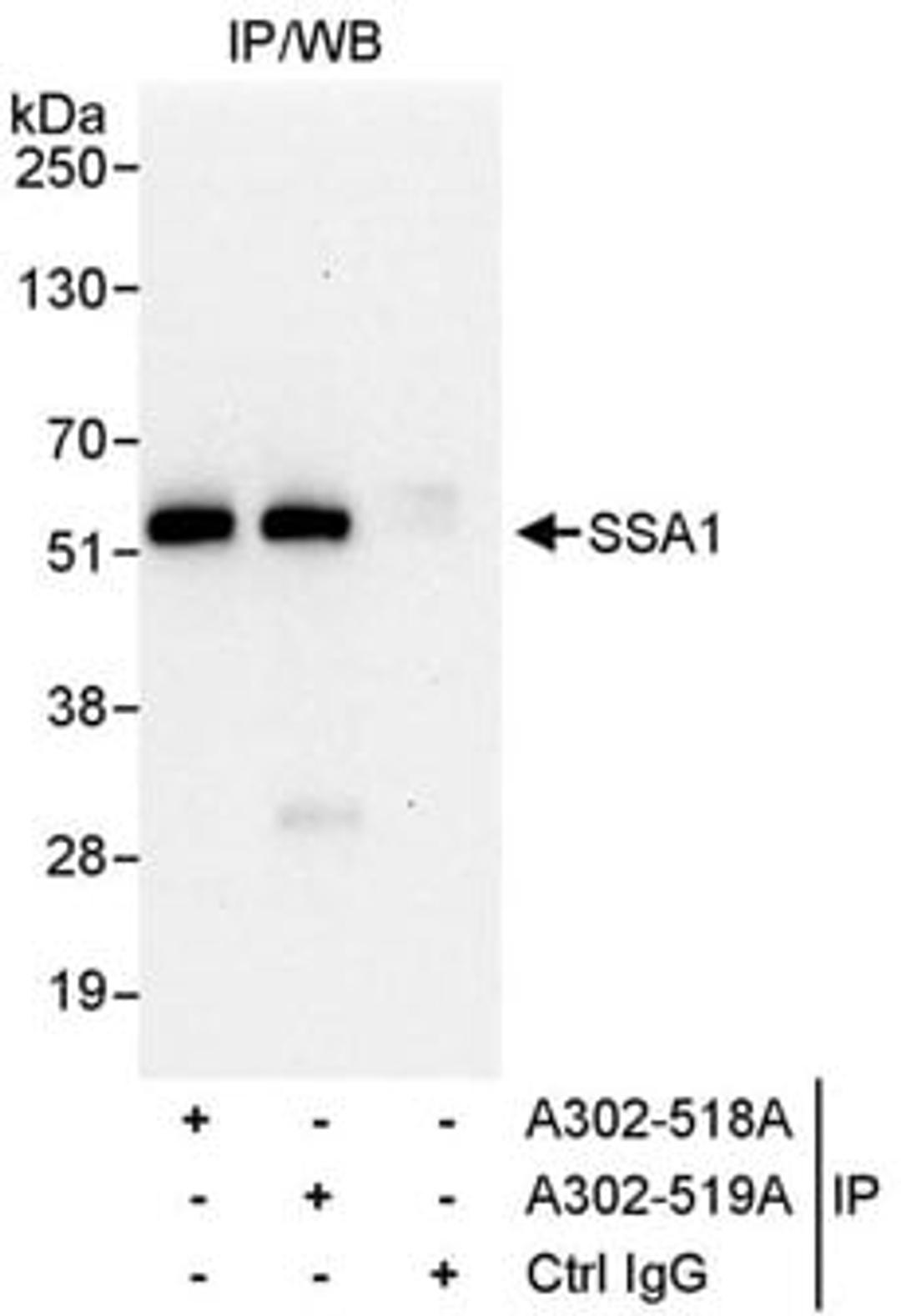 Detection of human SSA1 by western blot of immunoprecipitates.