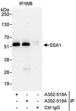 Detection of human SSA1 by western blot of immunoprecipitates.