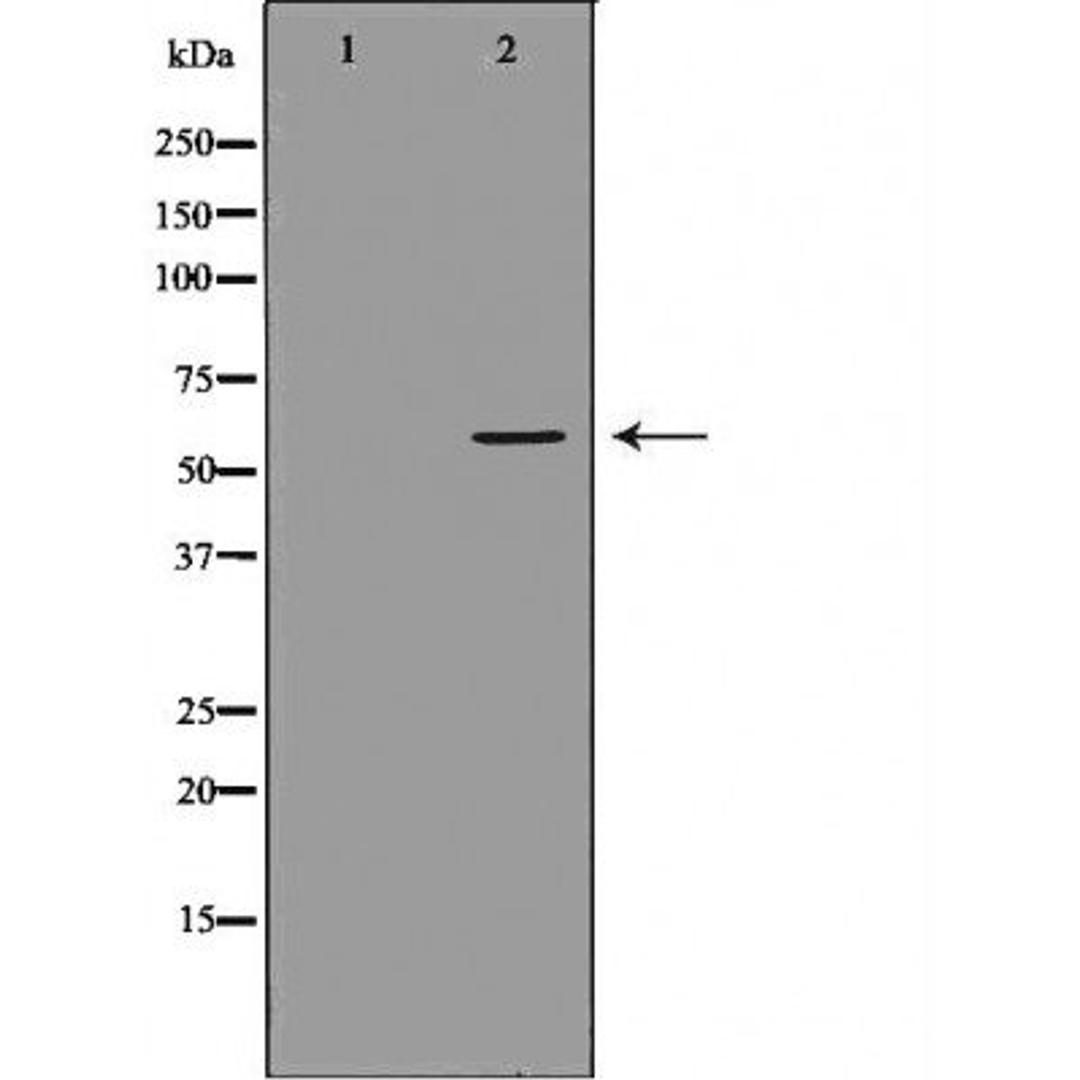 Western blot analysis of various cell lines using UGT1A4 antibody