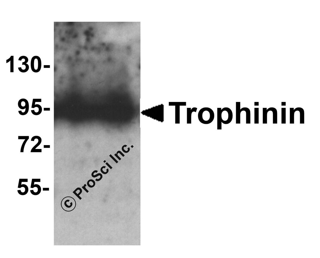 Western blot analysis of Trophinin in rat liver tissue lysate with Trophinin antibody at 1 μg/ml.