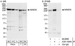 Detection of human and mouse NINEIN by western blot (h&m) and immunoprecipitation (h).