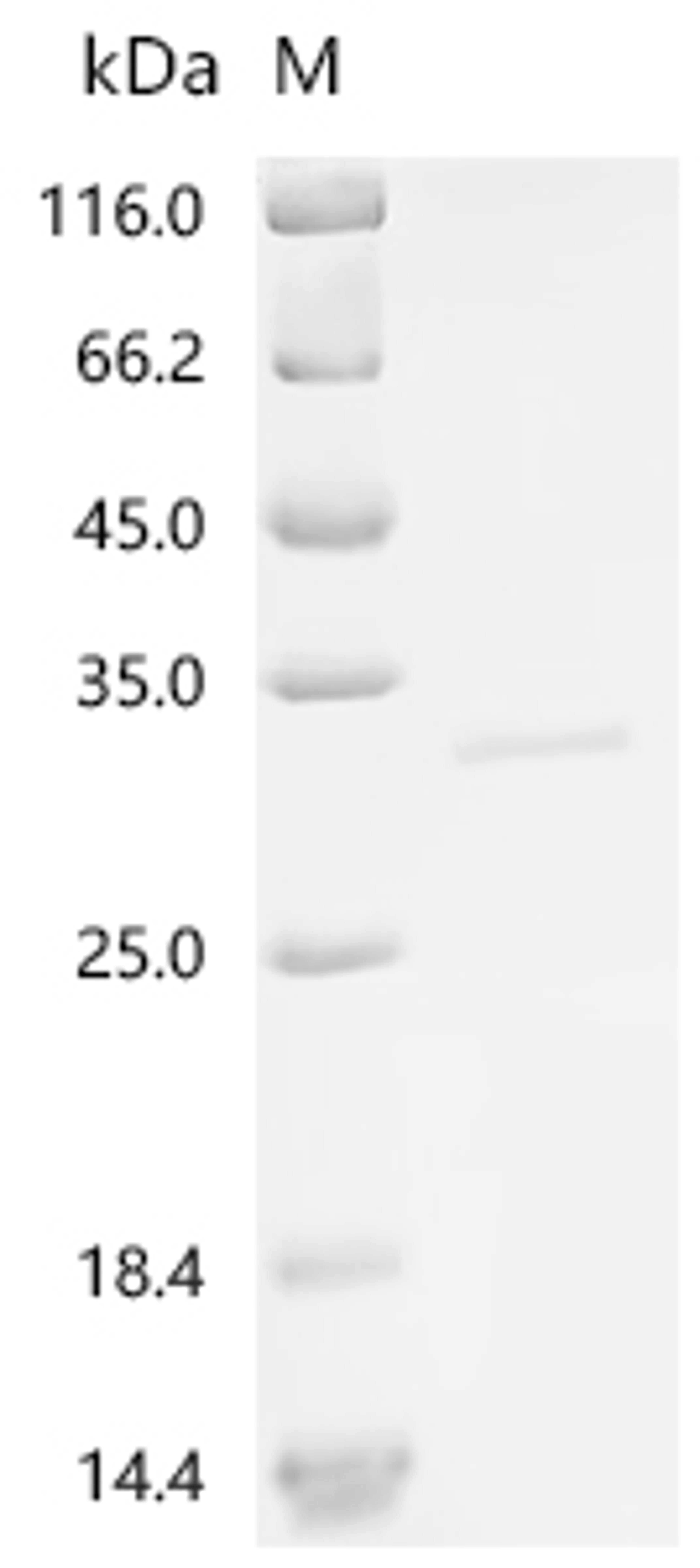 (Tris-Glycine gel) Discontinuous SDS-PAGE (reduced) with 5% enrichment gel and 15% separation gel.