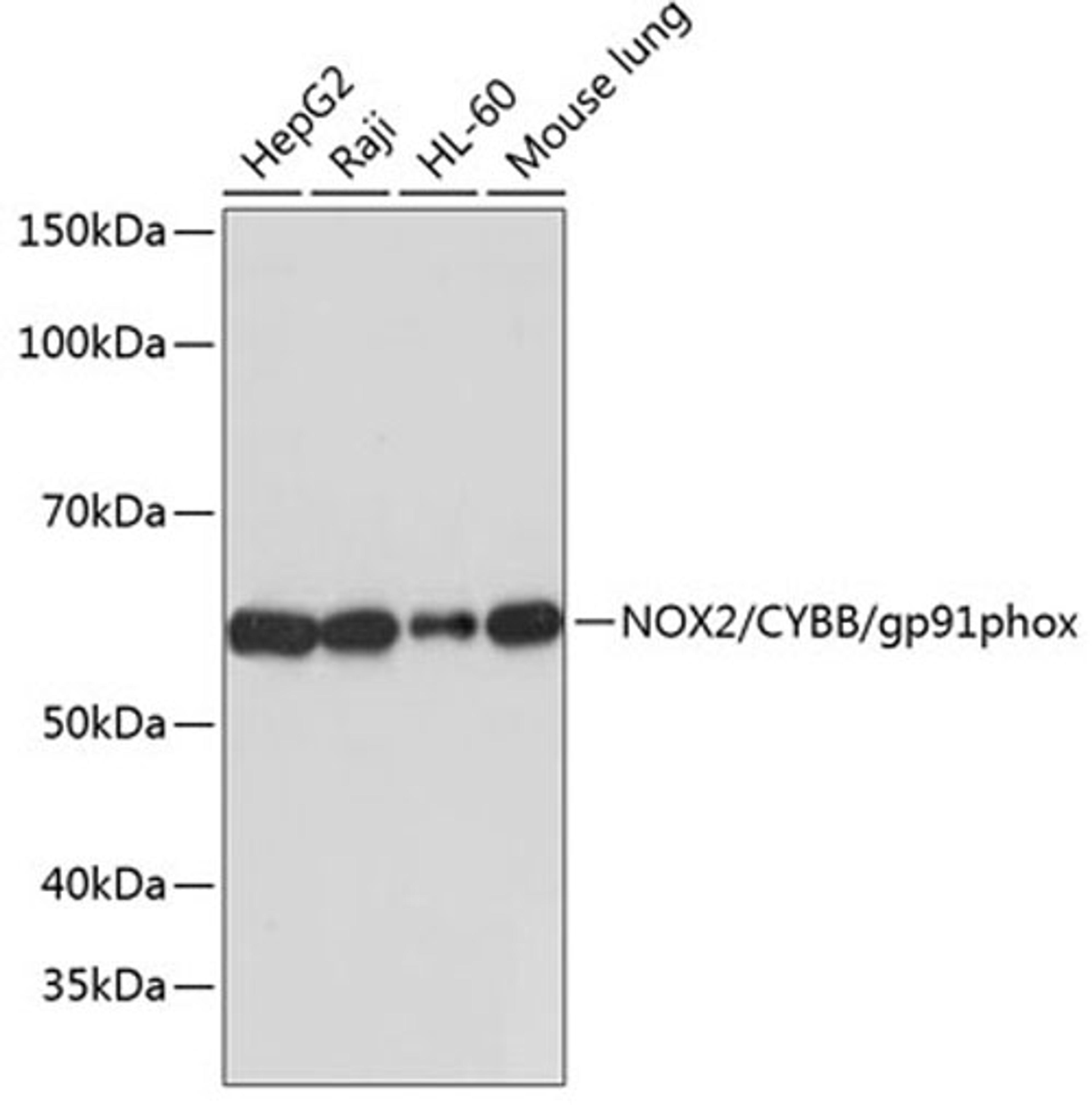 Western blot - NOX2/CYBB/gp91phox antibody (A19701)