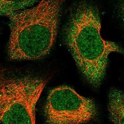 Immunocytochemistry/Immunofluorescence: C12orf60 Antibody [NBP1-91714] - Staining of human cell line U-2 OS shows positivity in nucleus & cytoplasm.