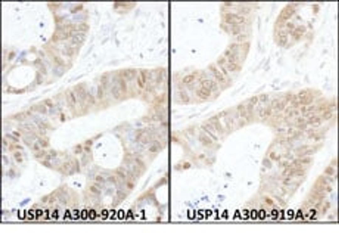 Detection of human USP14 by immunohistochemistry.