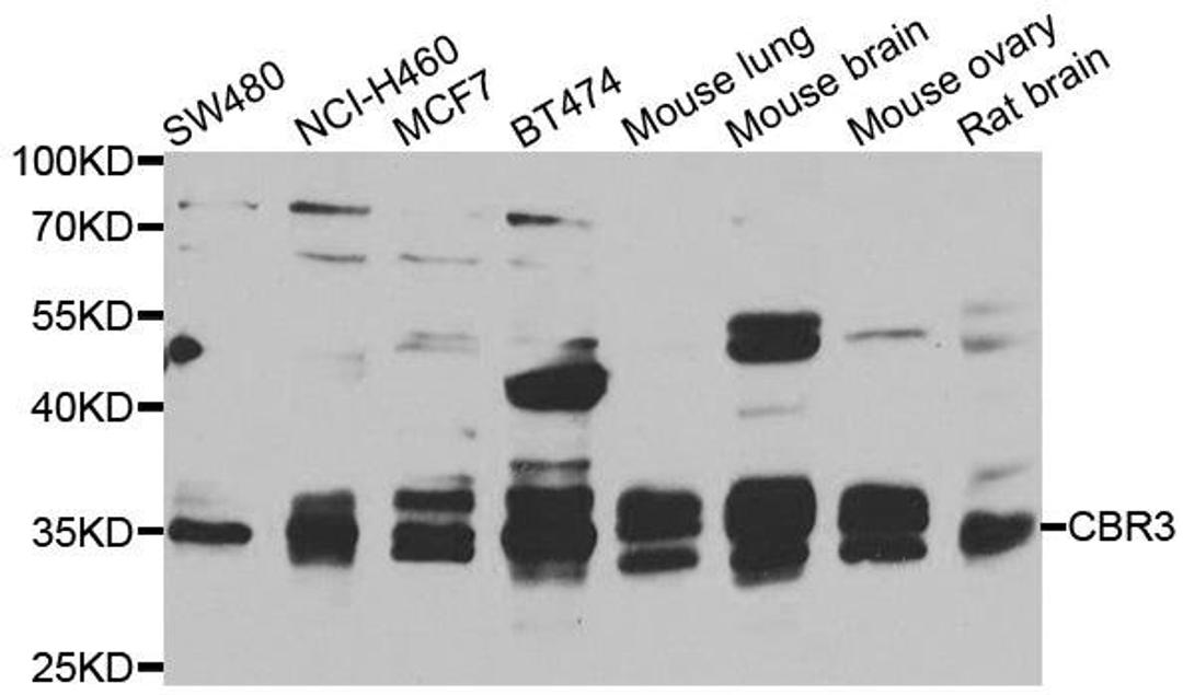 Western blot analysis of extracts of various cell lines using CBR3 antibody