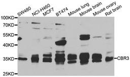 Western blot analysis of extracts of various cell lines using CBR3 antibody