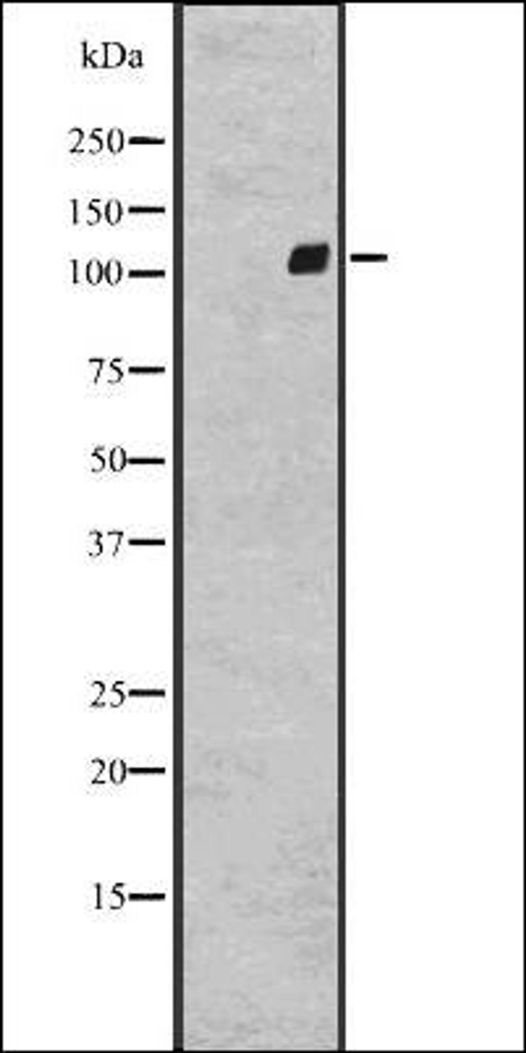 Western blot analysis of A431 whole cell lysate using GPR64 antibody