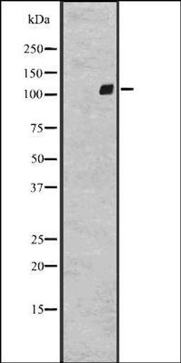 Western blot analysis of A431 whole cell lysate using GPR64 antibody