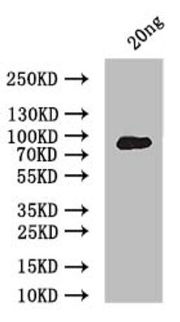 Western Blot. Positive WB detected in: recombinant protein. All lanes: ERVK-5 Antibody at 1:1000. Secondary. Goat polyclonal to rabbit IgG at 1/50000 dilution. Predicted band size: 90 kDa. Observed band size: 90 kDa.