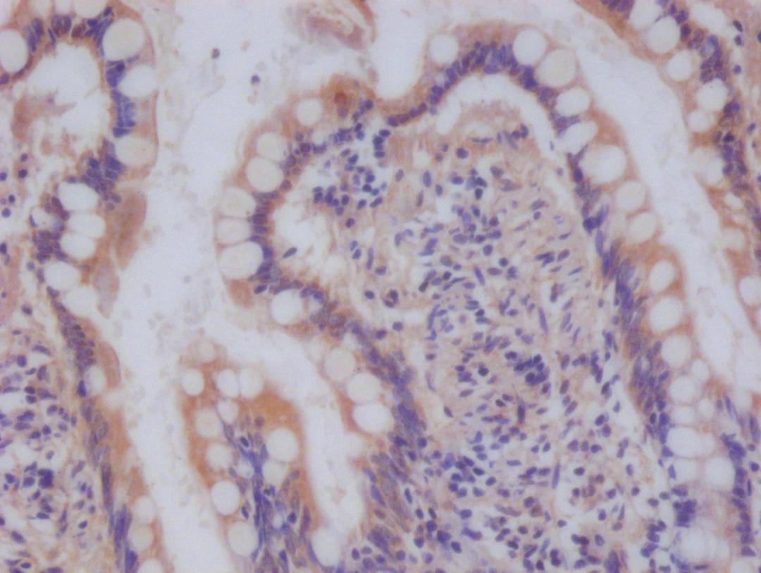 IHC image of CSB-RA588190A0HU diluted at 1:100 and staining in paraffin-embedded human small intestine tissue performed on a Leica BondTM system. After dewaxing and hydration, antigen retrieval was mediated by high pressure in a citrate buffer (pH 6.0). Section was blocked with 10% normal goat serum 30min at RT. Then primary antibody (1% BSA) was incubated at 4°C overnight. The primary is detected by a Goat anti-rabbit polymer IgG labeled by HRP and visualized using 0.05% DAB.
