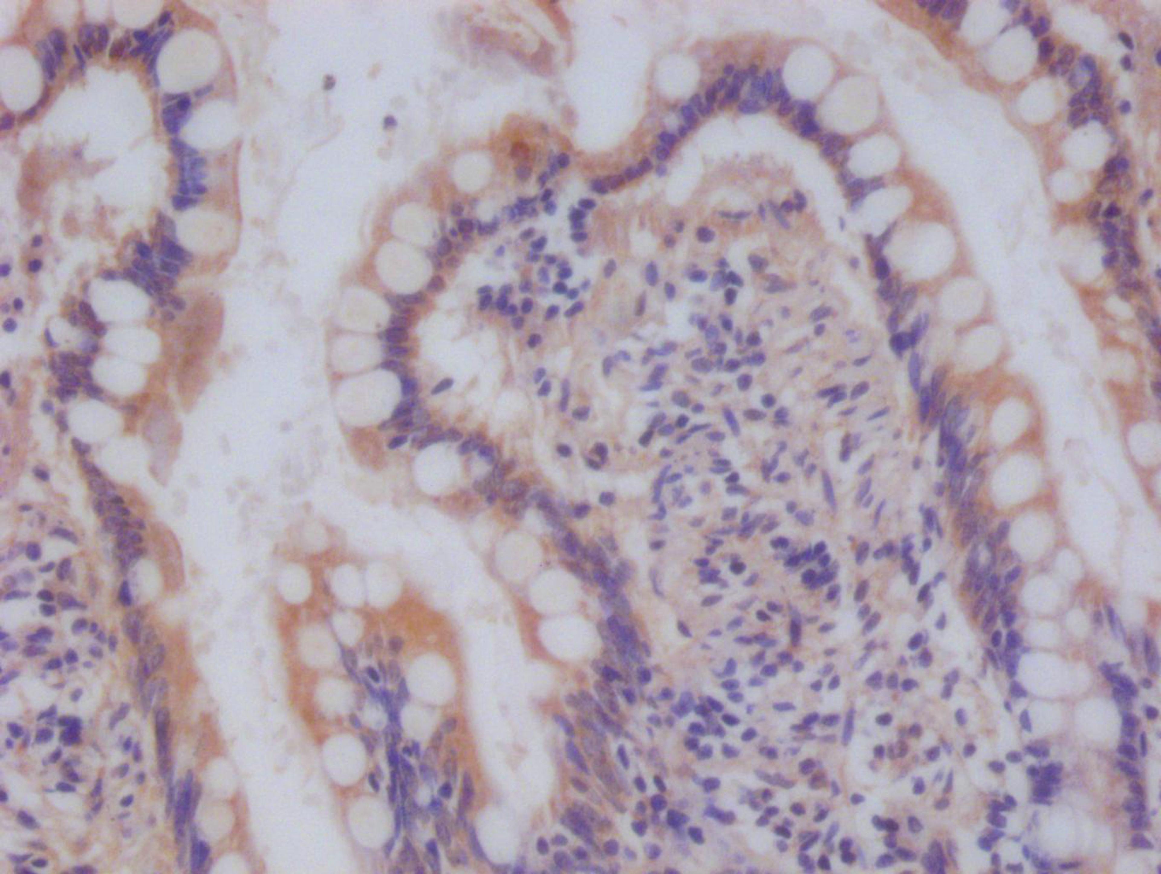 IHC image of CSB-RA588190A0HU diluted at 1:100 and staining in paraffin-embedded human small intestine tissue performed on a Leica BondTM system. After dewaxing and hydration, antigen retrieval was mediated by high pressure in a citrate buffer (pH 6.0). Section was blocked with 10% normal goat serum 30min at RT. Then primary antibody (1% BSA) was incubated at 4°C overnight. The primary is detected by a Goat anti-rabbit polymer IgG labeled by HRP and visualized using 0.05% DAB.