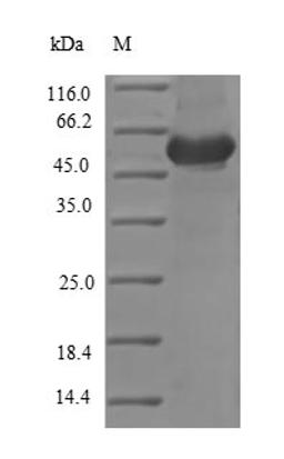 (Tris-Glycine gel) Discontinuous SDS-PAGE (reduced) with 5% enrichment gel and 15% separation gel.