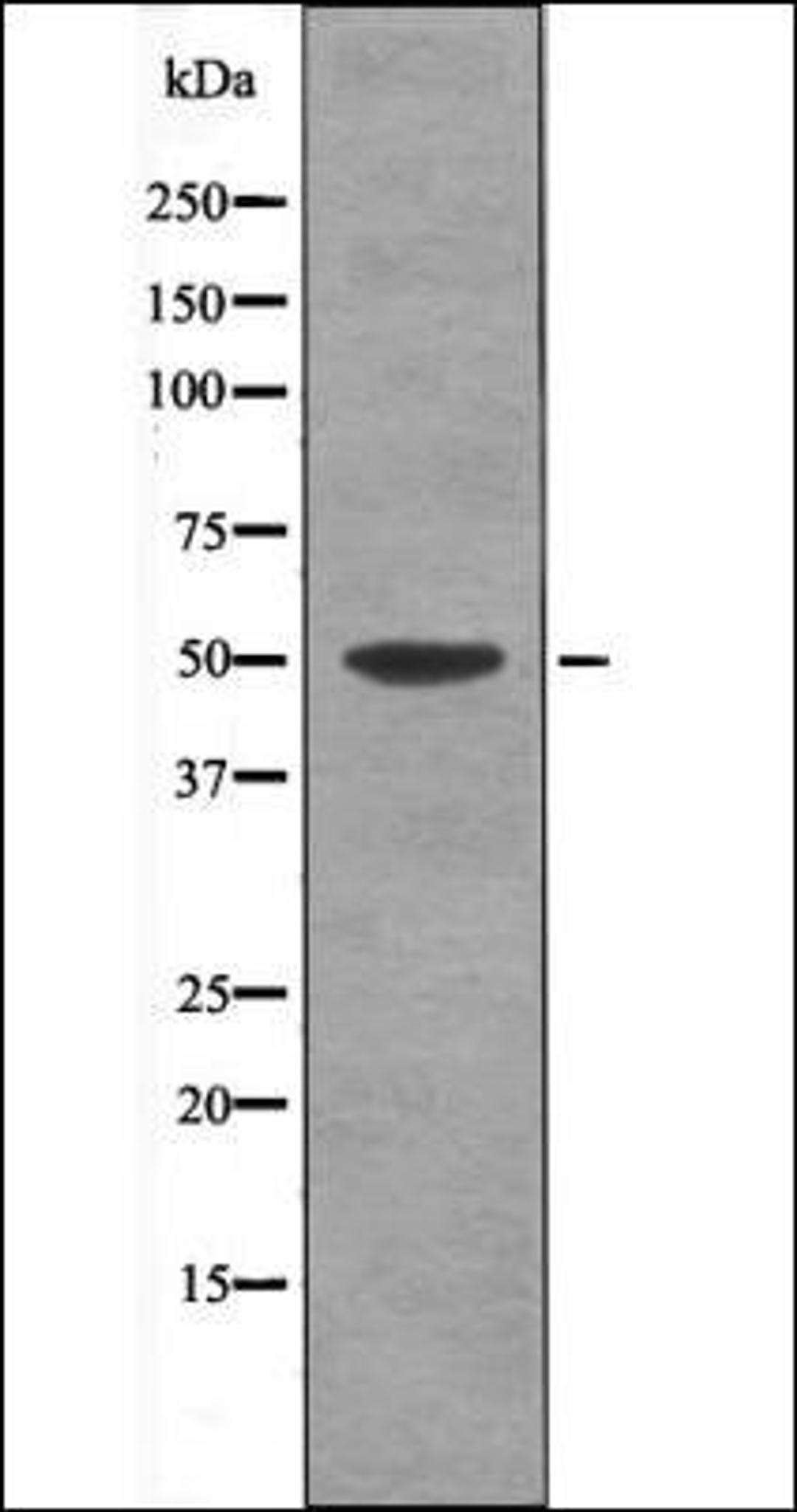 Western blot analysis of ovarycancer whole cell lysates using MAP2K5 -Phospho-Ser311- antibody