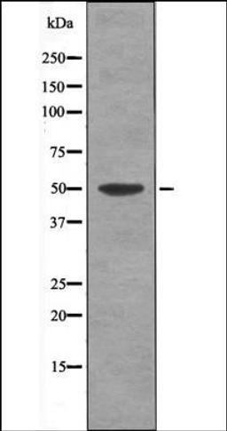 Western blot analysis of ovarycancer whole cell lysates using MAP2K5 -Phospho-Ser311- antibody