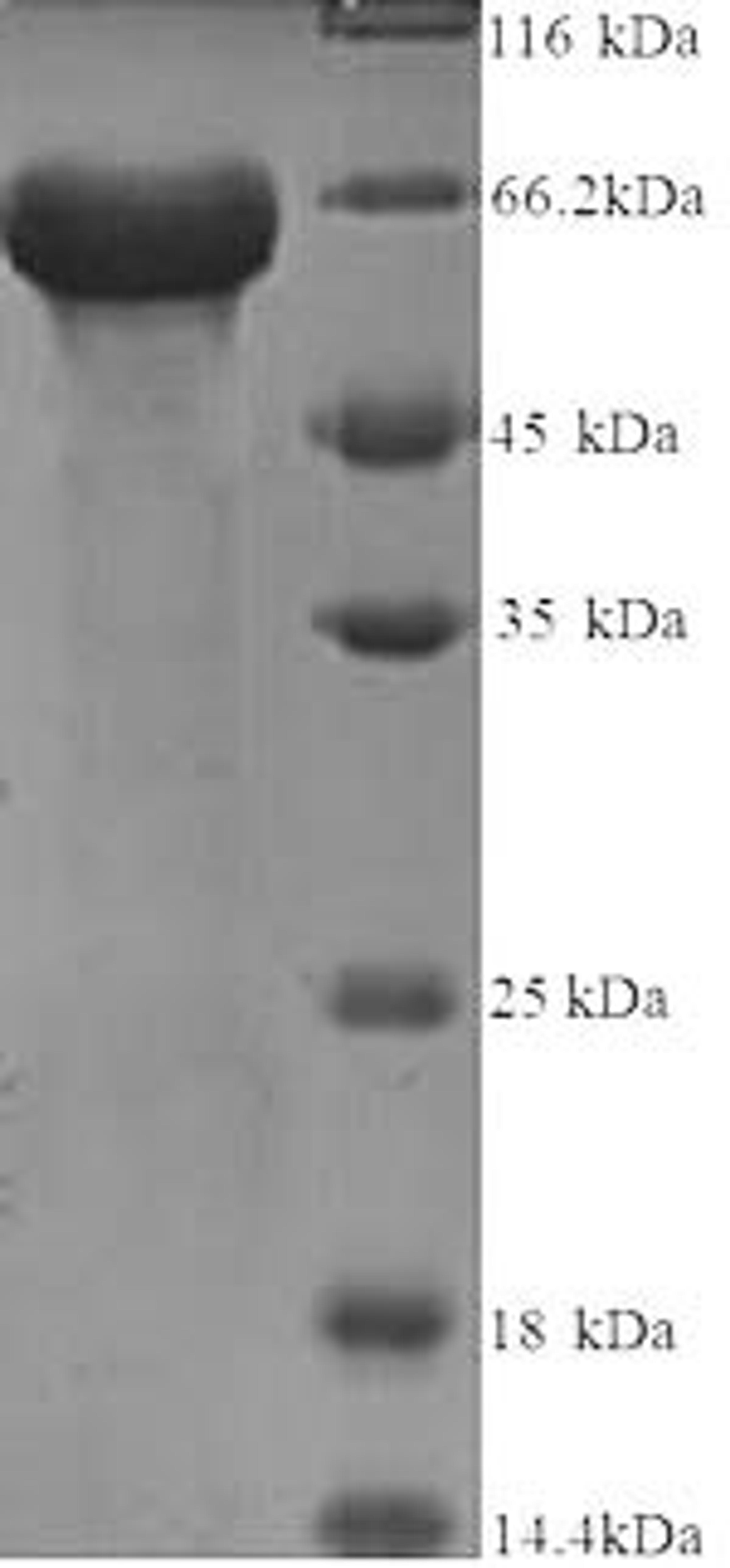 (Tris-Glycine gel) Discontinuous SDS-PAGE (reduced) with 5% enrichment gel and 15% separation gel.