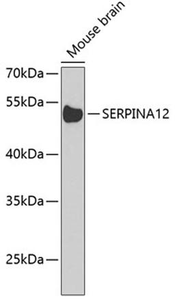 Western blot - SERPINA12 Antibody (A8074)