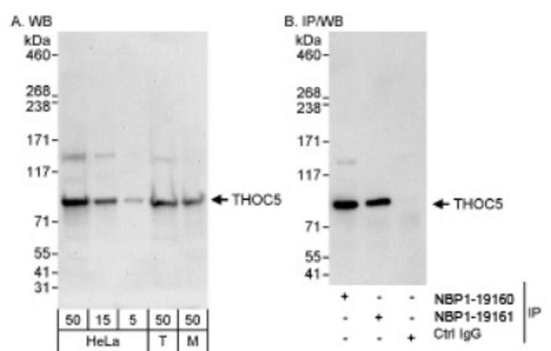 Western Blot: THOC5 Antibody [NBP1-19160] - Whole cell lysate from HeLa, 293T and mouse NIH3T3 cells. THOC5 was also immunoprecipitated by rabbit anti-THOC5 antibody NBP1-19161.