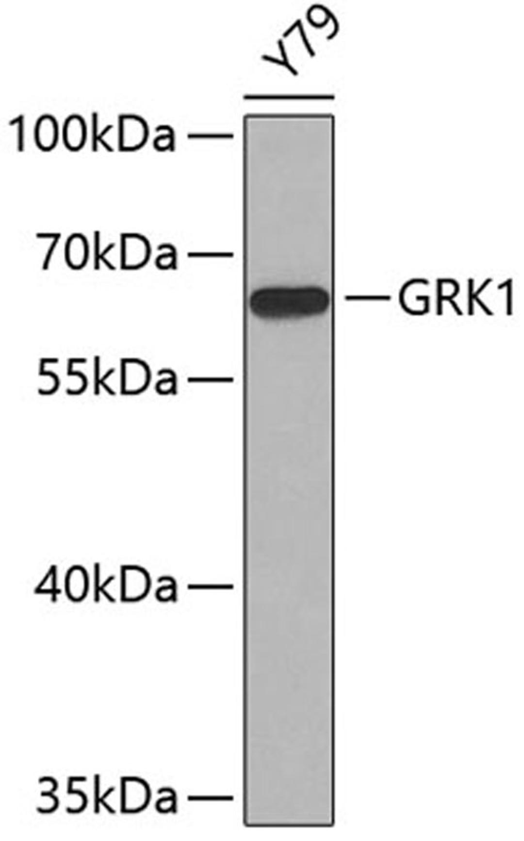 Western blot - GRK1 antibody (A6497)