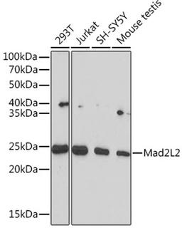 Western blot - Mad2L2 Rabbit mAb (A4630)