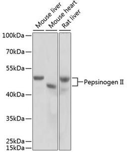 Western blot - Pepsinogen II antibody (A2788)