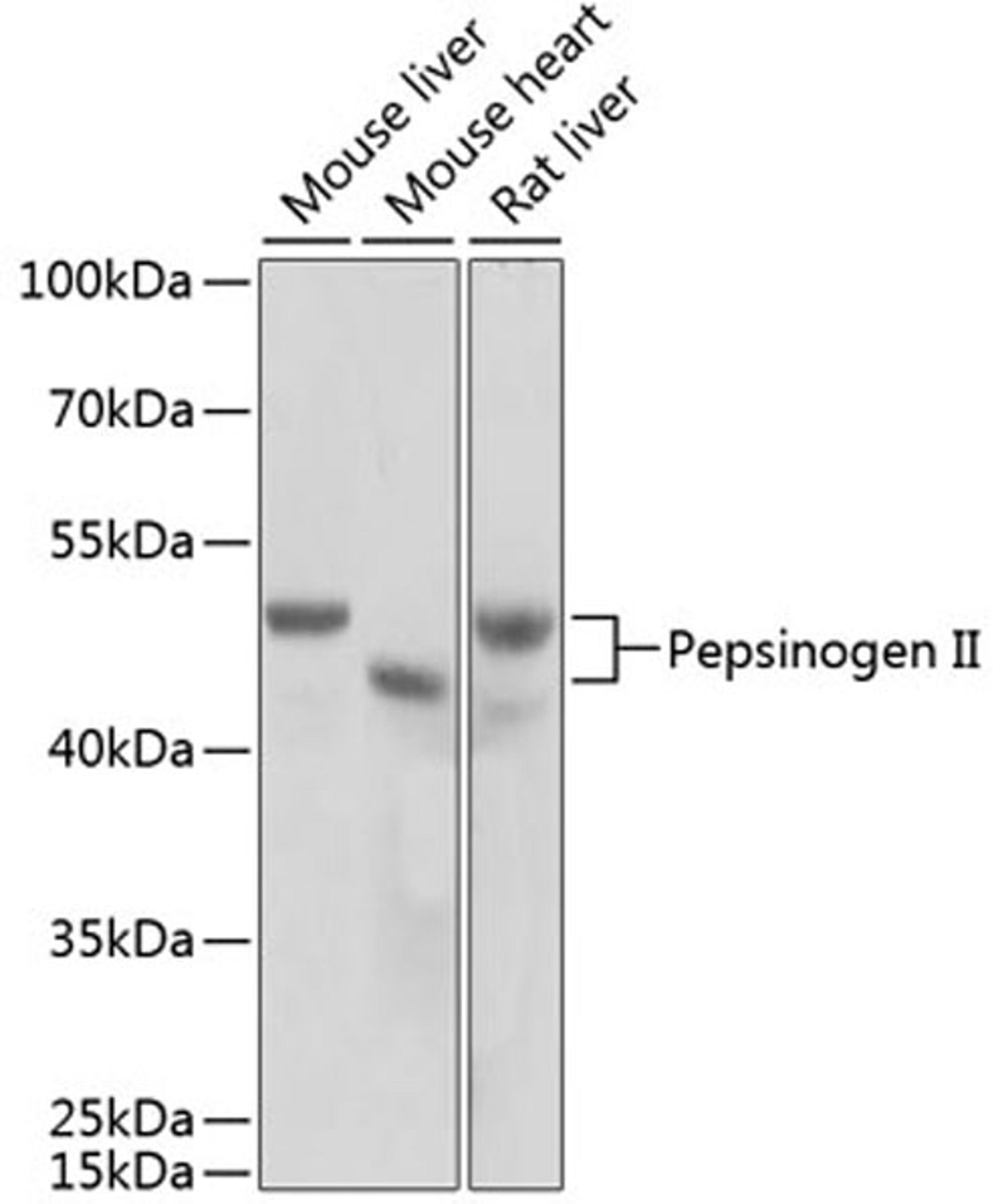 Western blot - Pepsinogen II antibody (A2788)