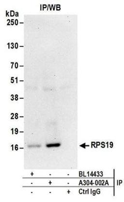 Detection of human RPS19 by western blot of immunoprecipitates.