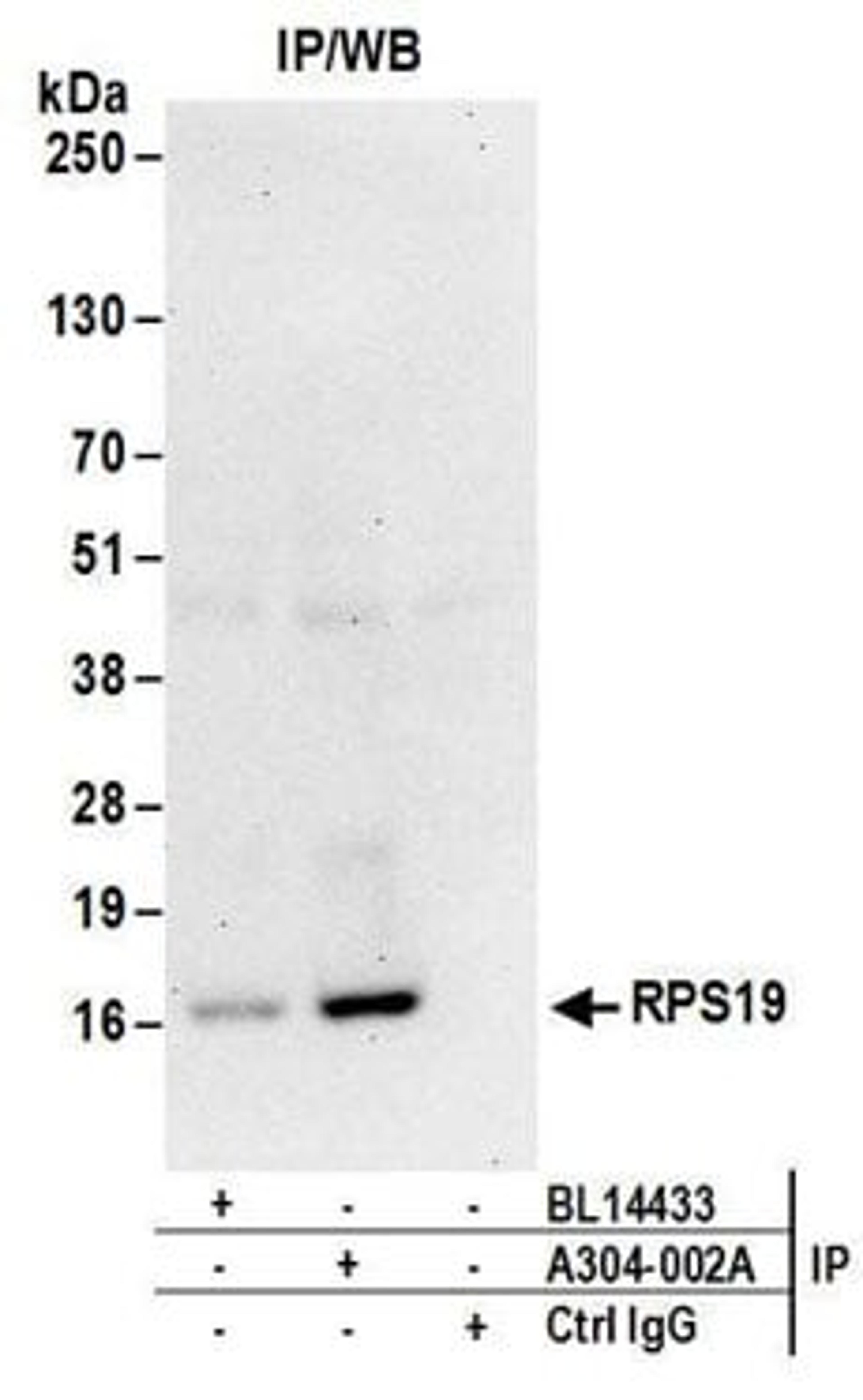 Detection of human RPS19 by western blot of immunoprecipitates.