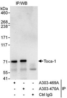 Detection of human Toca-1 by western blot of immunoprecipitates.