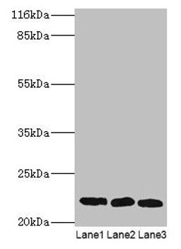 Western blot. All lanes: SSSCA1 antibody at 2µg/ml. Lane 1: A549 whole cell lysate. Lane 2: MCF-7 whole cell lysate. Lane 3: 293T whole cell lysate. Secondary. Goat polyclonal to rabbit IgG at 1/10000 dilution. Predicted band size: 22 kDa. Observed band size: 22 kDa