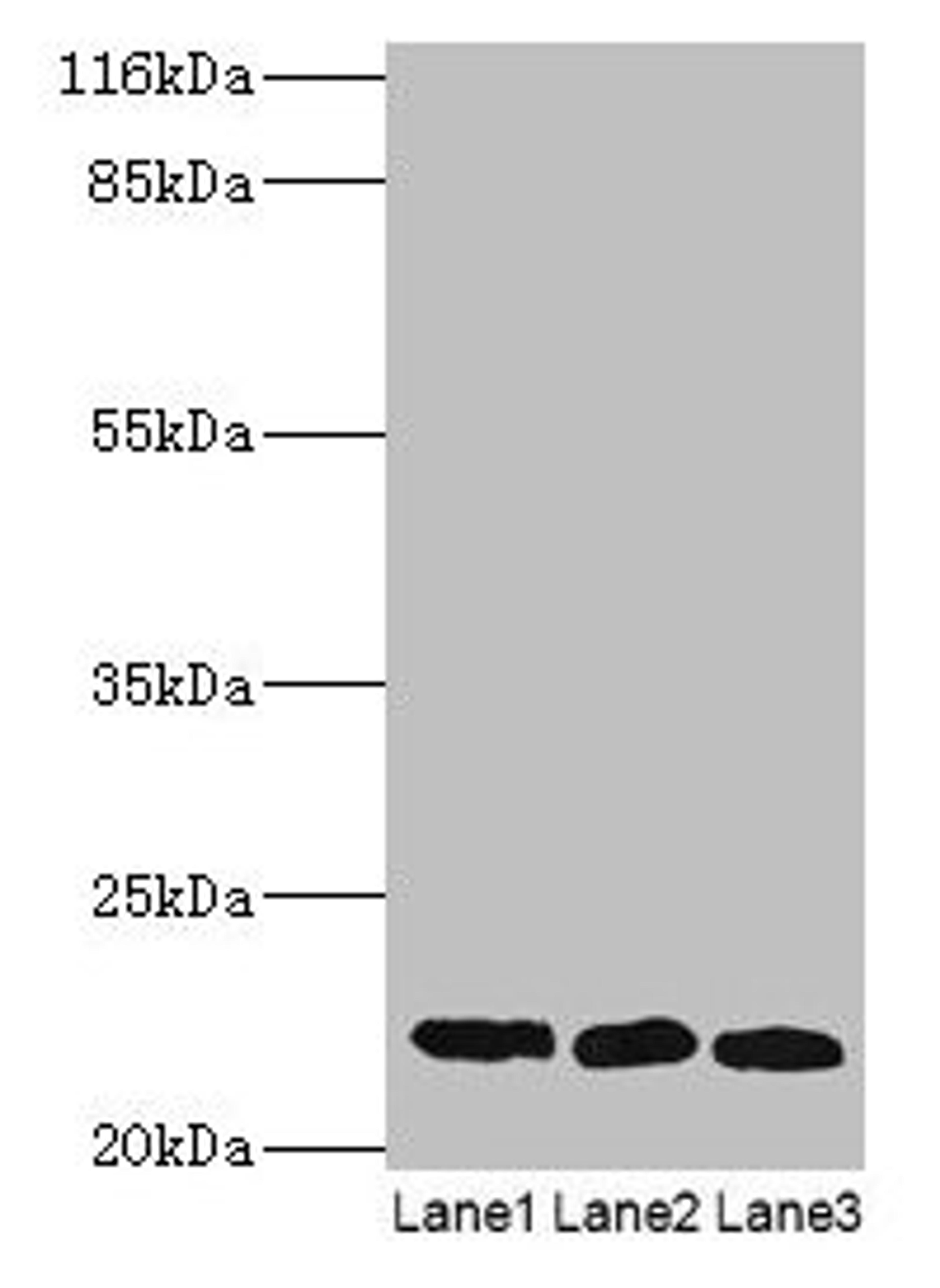 Western blot. All lanes: SSSCA1 antibody at 2µg/ml. Lane 1: A549 whole cell lysate. Lane 2: MCF-7 whole cell lysate. Lane 3: 293T whole cell lysate. Secondary. Goat polyclonal to rabbit IgG at 1/10000 dilution. Predicted band size: 22 kDa. Observed band size: 22 kDa