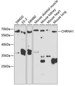 Western blot - CHRNA1 antibody (A5306)