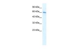 Antibody used in WB on Human Jurkat 1.25 ug/ml.