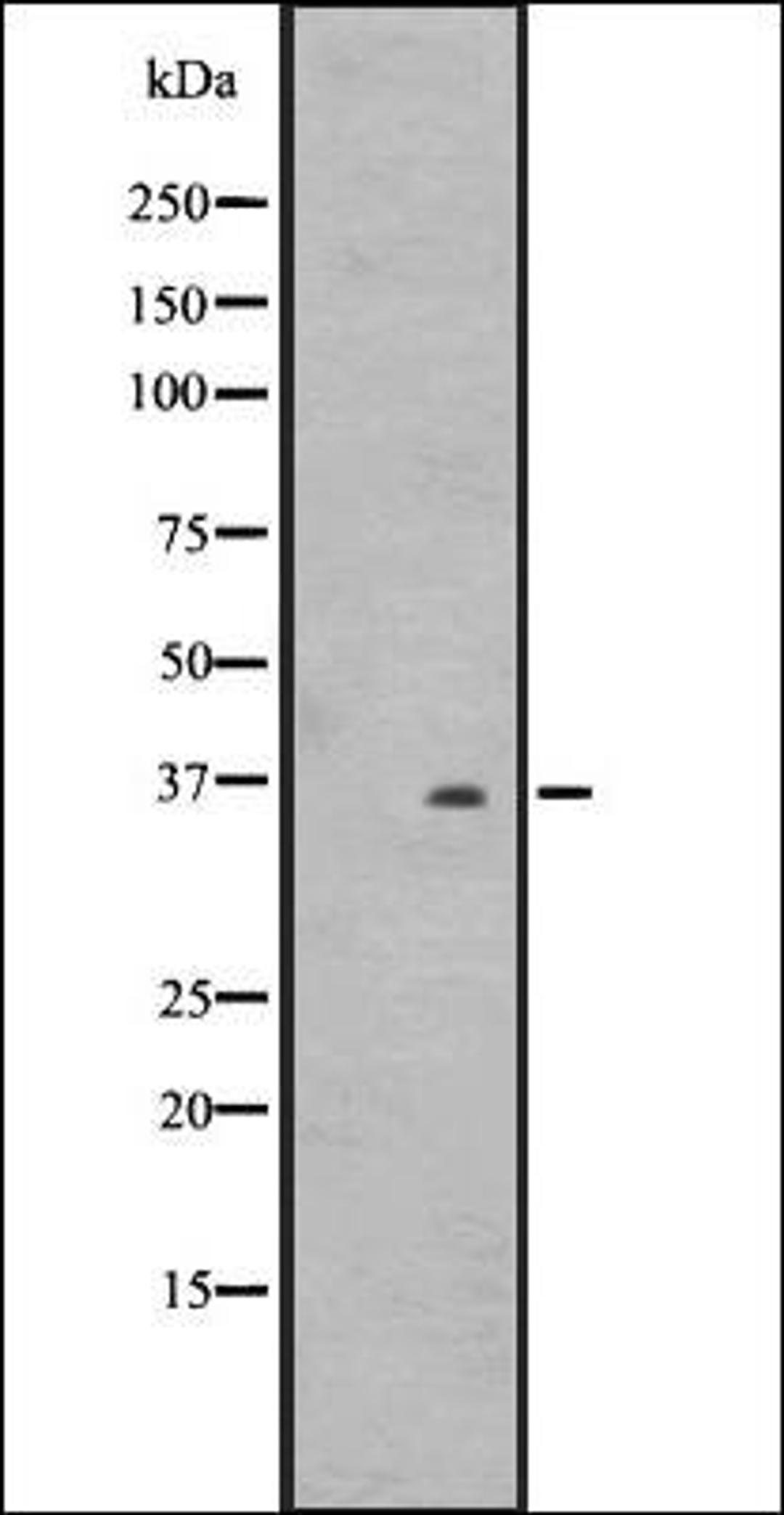 Western blot analysis of WiDr cell lysate HT1080 whole cell lysate using OR2T8/2T12/2T33 antibody