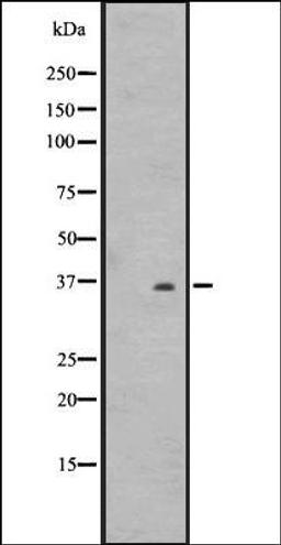 Western blot analysis of WiDr cell lysate HT1080 whole cell lysate using OR2T8/2T12/2T33 antibody